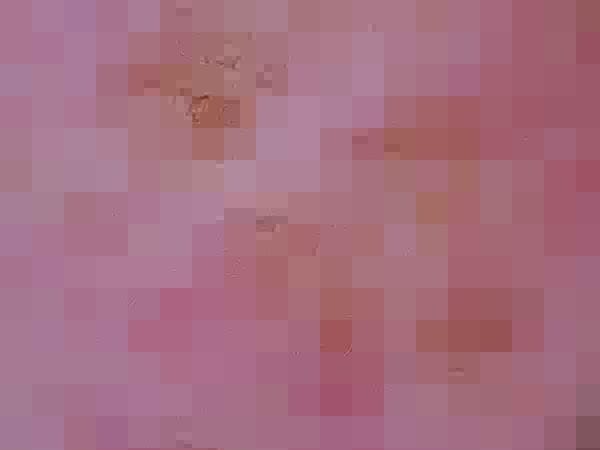 Opcja