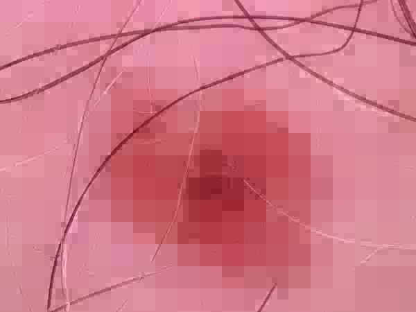 Opcja